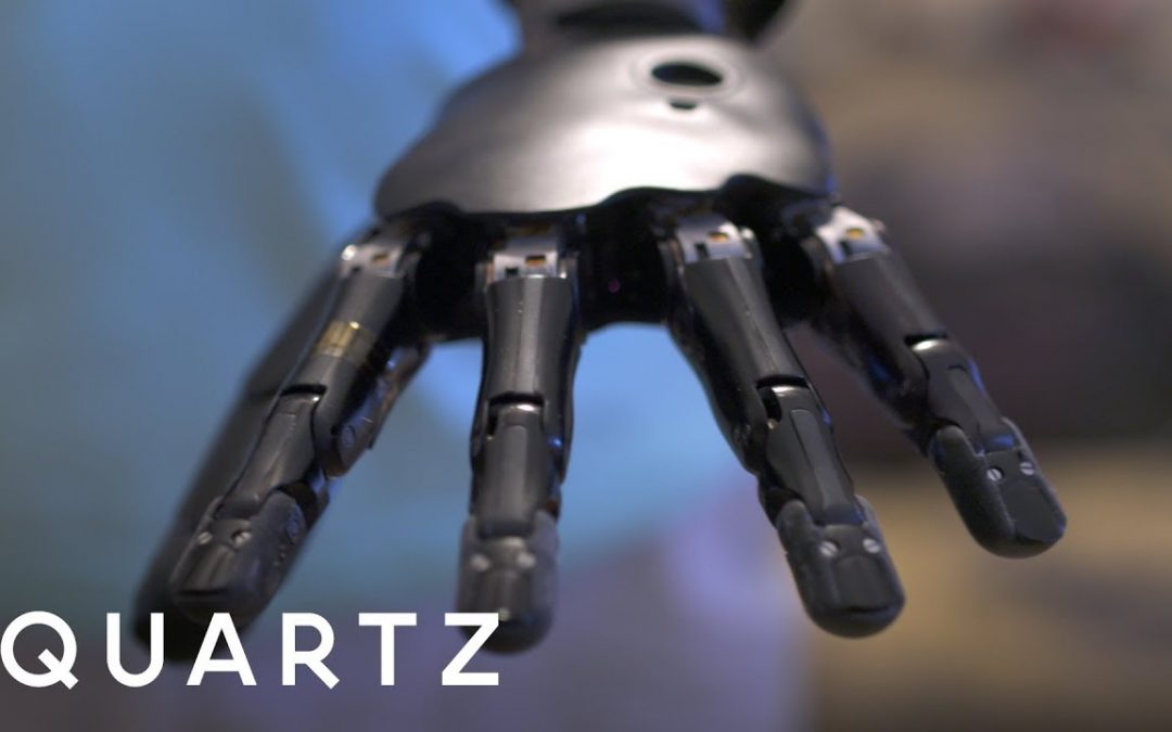 Living with a mind-controlled robot arm